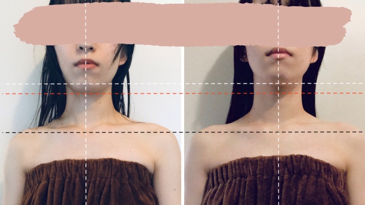 ビフォーアフター