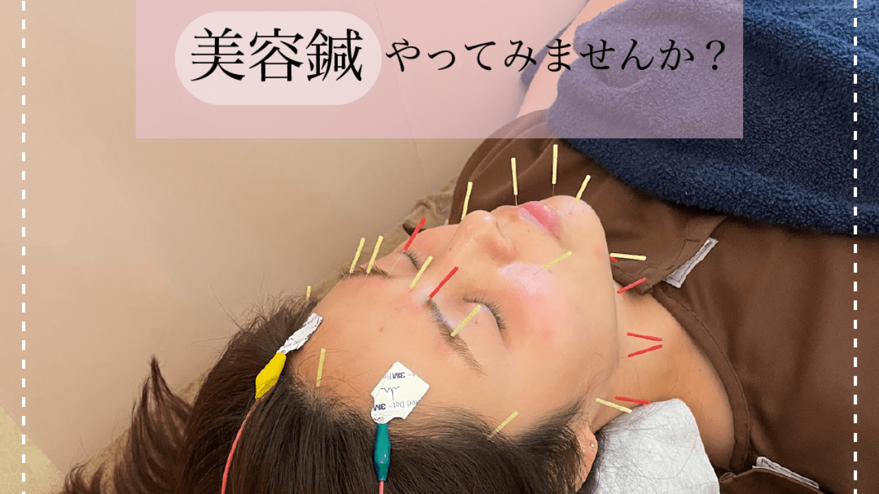 美容鍼体験してみませんか？