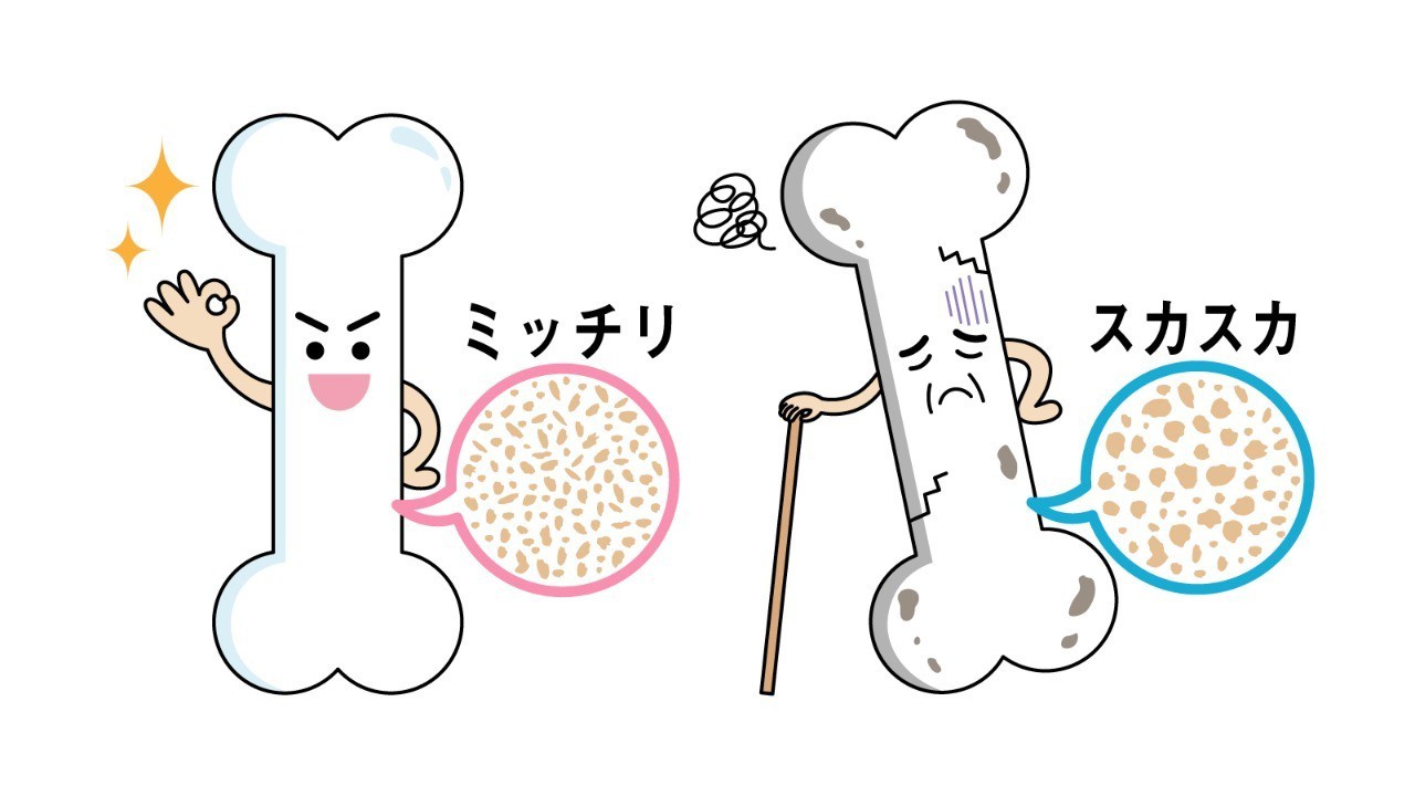 骨のお話